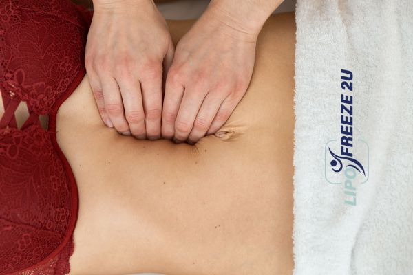 diastasis recti treatment Hampton Court