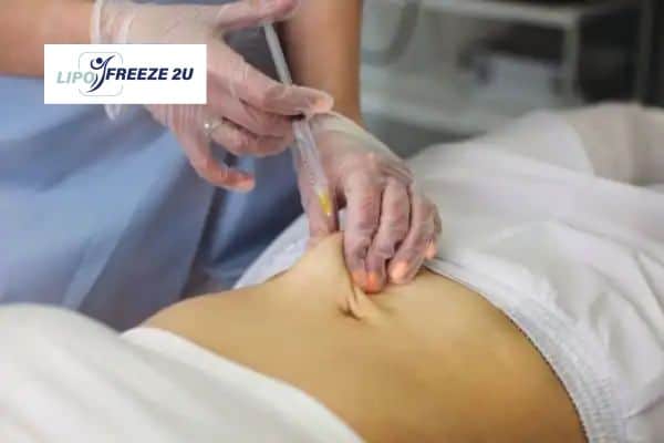 How Does Aqualyx Fat Dissolving Injection Work to Break Down Fat Hampton Court?