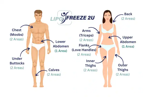 Areas you can have fat freezing treatment Hampton Court