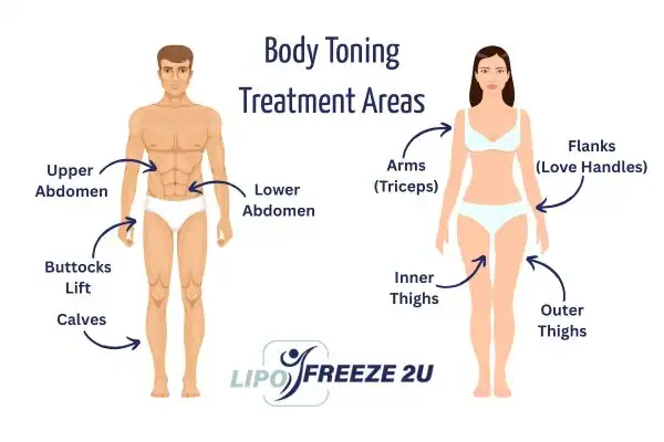 Graphic showing where you can have Body toning Treatment Hampton Court on your body