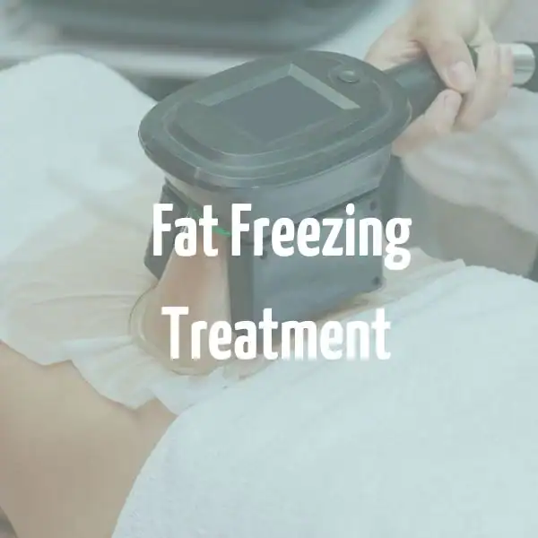fat freezing treatment Hampton Court