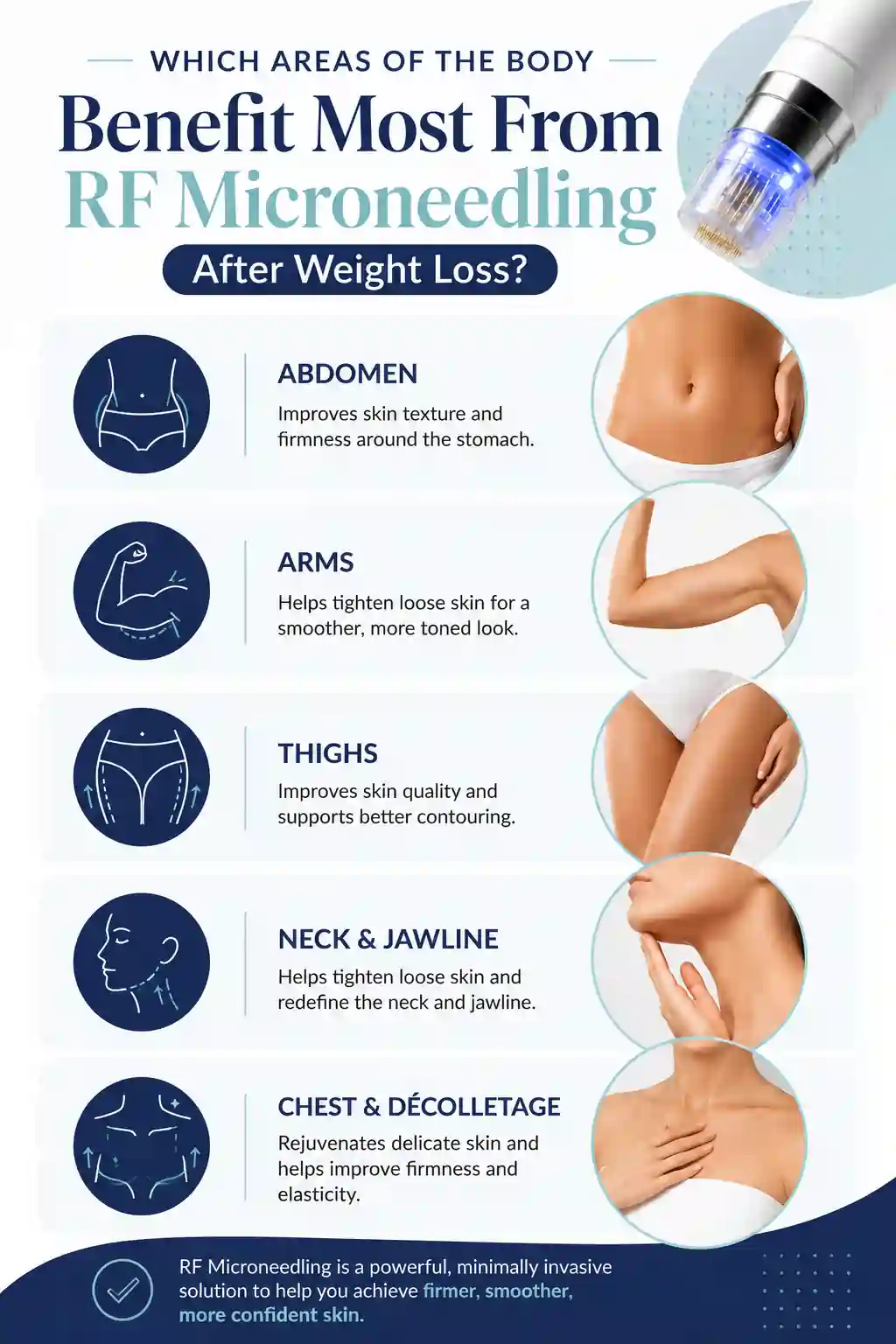 Which Areas of the Body Benefit Most From RF Microneedling After Weight Loss Hampton Court